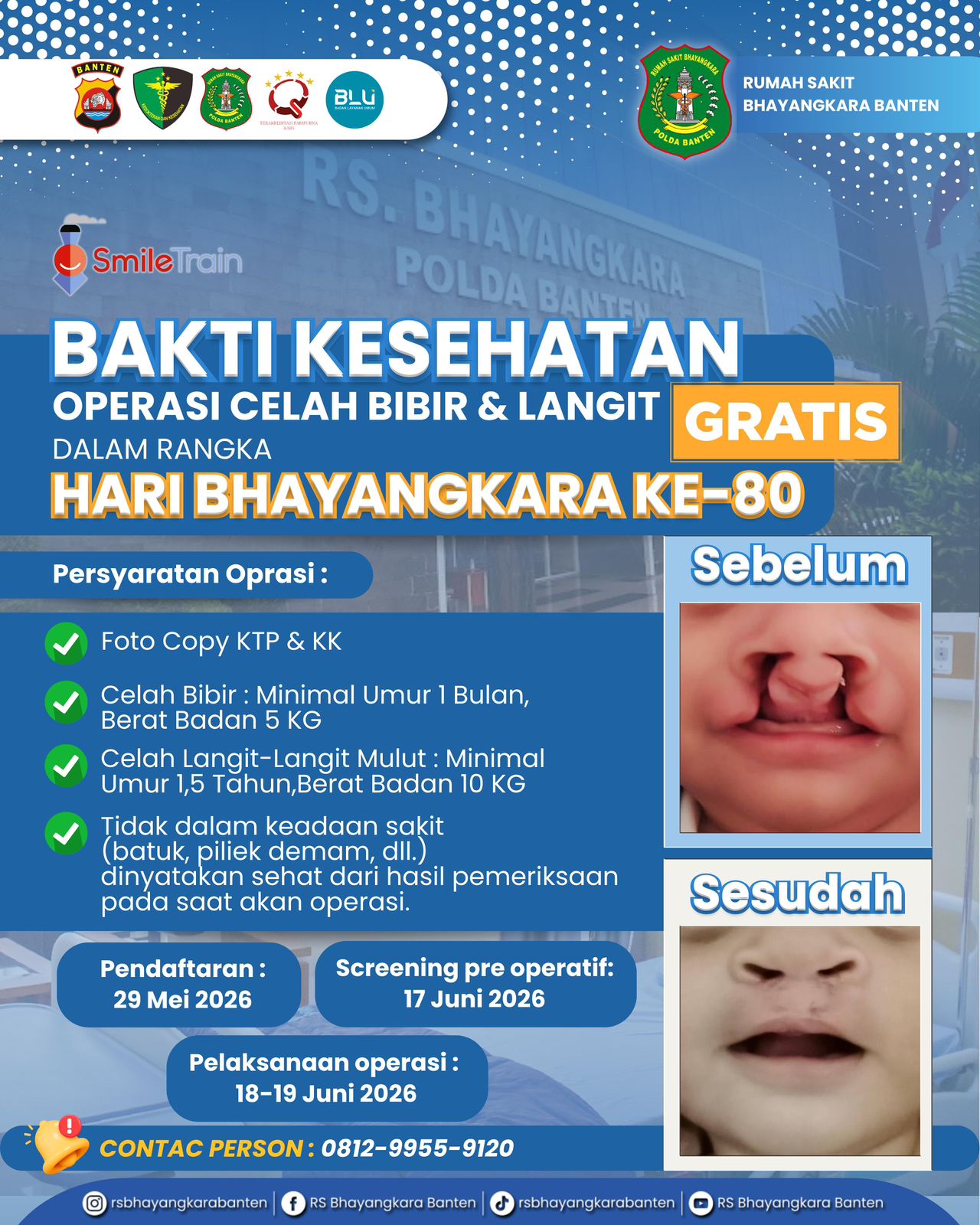 Semarak Hari Bhayangkara ke-80, Polda Banten Gelar Donor Darah dan Khitanan Gratis