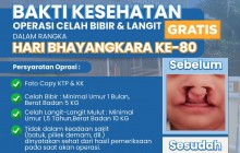 Semarak Hari Bhayangkara ke-80, Polda Banten Gelar Donor Darah dan Khitanan Gratis